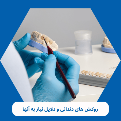 روکش های دندانی و دلایل نیاز به آنها
